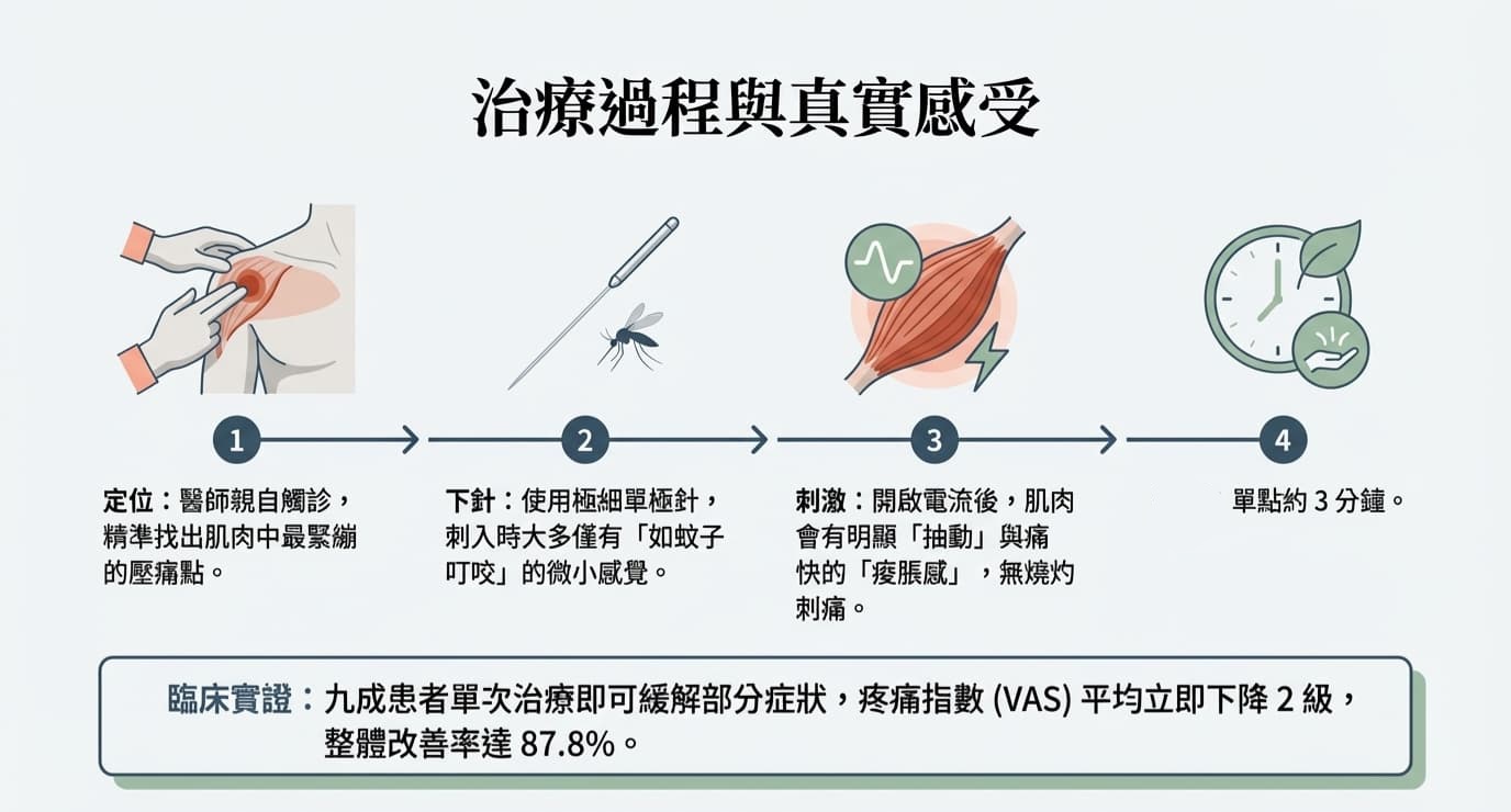 解釋針極肌肉內電刺激NEIMS的治療過程